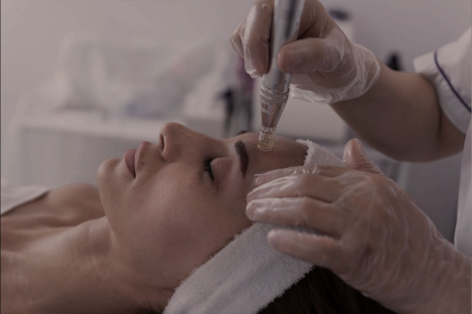 Microdermabrasion-L